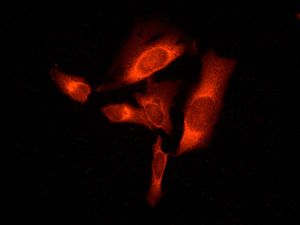 Immunofluorescent staining of HeLa cells using anti-Metadherin antibody.