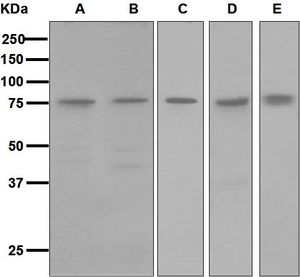 Western blot analysis on (A) HeLa, (B) Jurkat, (C) PC-3, (D) PC-12, and (E) NIH/3T3 cell lysates using anti-Metadherin antibody.