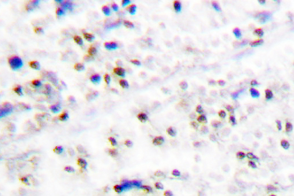 IHC of MCM5 (F51) pAb in paraffin-embedded human tonsil tissue.