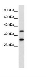 HepG2 Cell Lysate