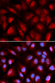 Immunofluorescence analysis of U20S cell using MCM5 antibody. Blue: DAPI for nuclear staining.
