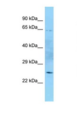 MTG1 antibody LS-C146222 Western blot of Placenta lysate. Antibody concentration 1 ug/ml.