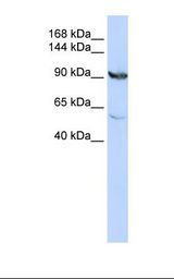 HepG2 cell lysate. Antibody concentration: 1.0 ug/ml. Gel concentration: 6-18%.