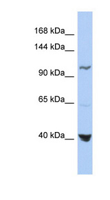 MTHFD1 antibody LS-B5794 Western blot of OVCAR-3 cell lysate.