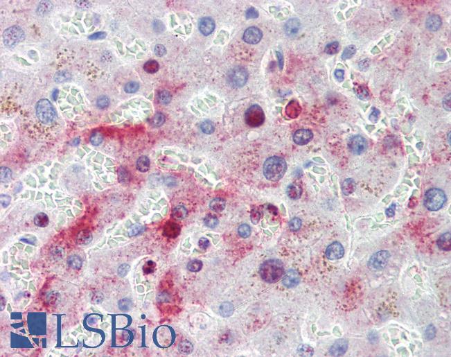 Anti-MTHFD1 antibody IHC of human liver. Immunohistochemistry of formalin-fixed, paraffin-embedded tissue after heat-induced antigen retrieval. Antibody LS-B4110 concentration 3.75 ug/ml.