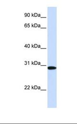 293T cell lysate. Antibody concentration: 1.0 ug/ml. Gel concentration: 12%.