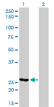 Western blot of MTHFD2 expression in transfected 293T cell line by MTHFD2 monoclonal antibody (M01), clone 4G7-2G3.