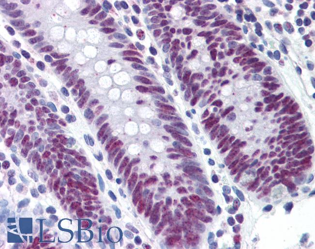 Anti-MCM5 antibody IHC of human colon. Immunohistochemistry of formalin-fixed, paraffin-embedded tissue after heat-induced antigen retrieval. Antibody LS-B2509 dilution 1:50.