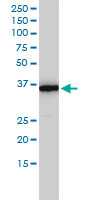 MTHFD2 monoclonal antibody (M01), clone 4G7-2G3 Western blot of MTHFD2 expression in HepG2.