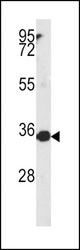 Western blot of MTHFD2 antibody in NCI-H460 cell line lysates (35 ug/lane). MTHFD2 (arrow) was detected using the purified antibody.