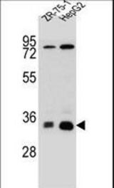 MTHFD2L Antibody western blot of HepG2,ZR-75-1 cell line lysates (35 ug/lane). The MTHFD2L antibody detected the MTHFD2L protein (arrow).