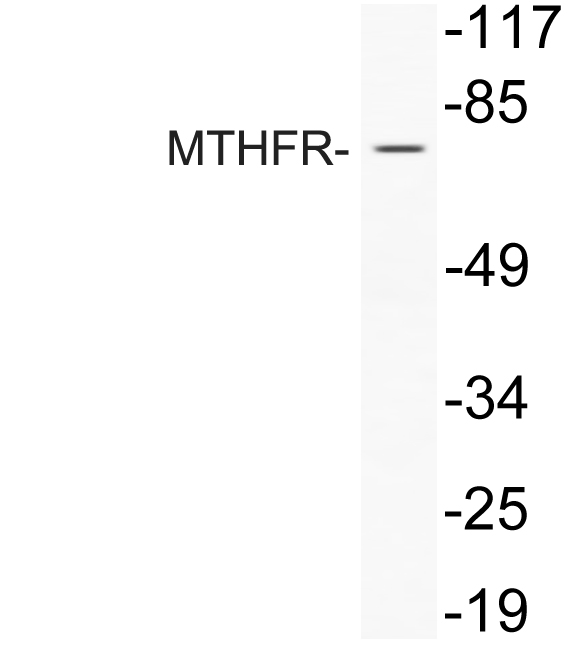 Western blot of MTHFR (R363) pAb in extracts from COLO205 cells treated with Forskolin.