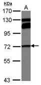 Sample (30 ug of whole cell lysate) A: A549 7.5% SDS PAGE MTHFR antibody diluted at 1:1000