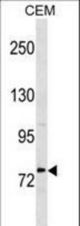 MTHFR Antibody western blot of CEM cell line lysates (35 ug/lane). The MTHFR antibody detected the MTHFR protein (arrow).