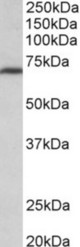 MTHFR antibody (0.3 ug/ml) staining of NIH3T3 lysate (35 ug protein in RIPA buffer). Primary incubation was 1 hour. Detected by chemiluminescence.