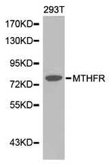 Western blot analysis of extracts of 293T cell line, using MTHFR antibody.