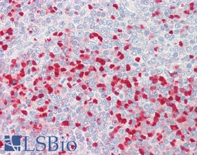 Anti-MTHFR antibody IHC staining of human spleen. Immunohistochemistry of formalin-fixed, paraffin-embedded tissue after heat-induced antigen retrieval.