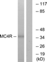 Western blot of extracts from MCF-7 cells, using MC4R Antibody. The lane on the right is treated with the synthesized peptide.