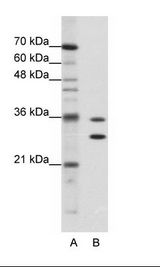 A: Marker, B: Jurkat Cell Lysate