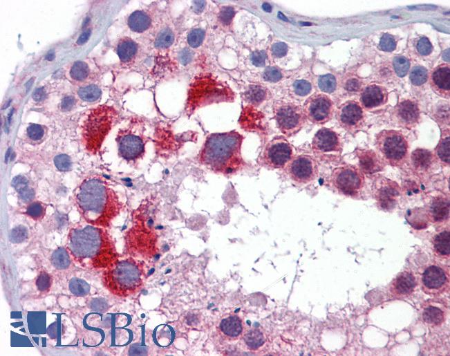 Anti-MTL5 antibody IHC of human testis. Immunohistochemistry of formalin-fixed, paraffin-embedded tissue after heat-induced antigen retrieval. Antibody LS-B5836 concentration 5 ug/ml.
