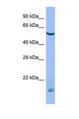 MTM1 antibody LS-C146521 Western blot of Mouse Thymus lysate. Antibody concentration 1 ug/ml.