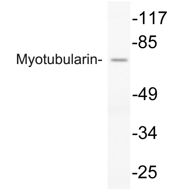 Western blot of Myotubularin (Y290) pAb in extracts from COLO205 cells.