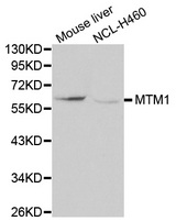 Western blot analysis of extracts of mouse liver tissue and NCL-H460 cells, using MTM1 antibody.
