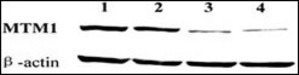 Western blot showing knockdown of endogenous MTM1 expression by MTM1-targeting vectors pDM134 and pDM170. Embryonic stem (ES) cells were untreated (lane 1) or transfected with control plasmid pDCont (lane 2), MTM1-targeting plasmid pDM134 (lane 3), or pDM170 (lane 4). The blot was probed with anti-MTM1 rabbit polyclonal antibodies. -Actin was used as a loading control.