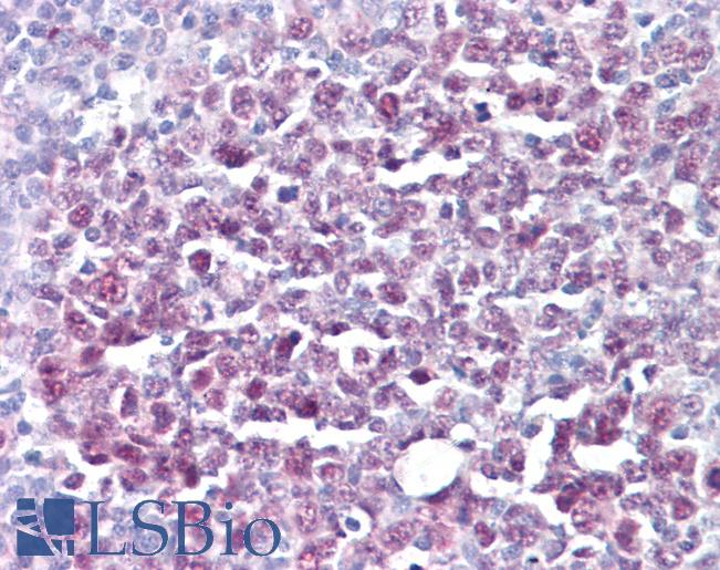 Anti-MCM5 antibody IHC of human tonsil. Immunohistochemistry of formalin-fixed, paraffin-embedded tissue after heat-induced antigen retrieval. Antibody LS-B6277 concentration 10 ug/ml.