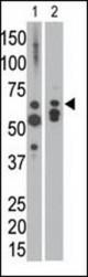 The anti-MTM1 C-term antibody is used in Western blot to detect MTM1 in NCI-H460 cell lysate (lane 1) and in mouse heart tissue lysate (lane 2).