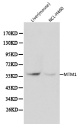Western blot of MTM1 pAb in extracts from mouse liver tissue and NCL-H460 cells.