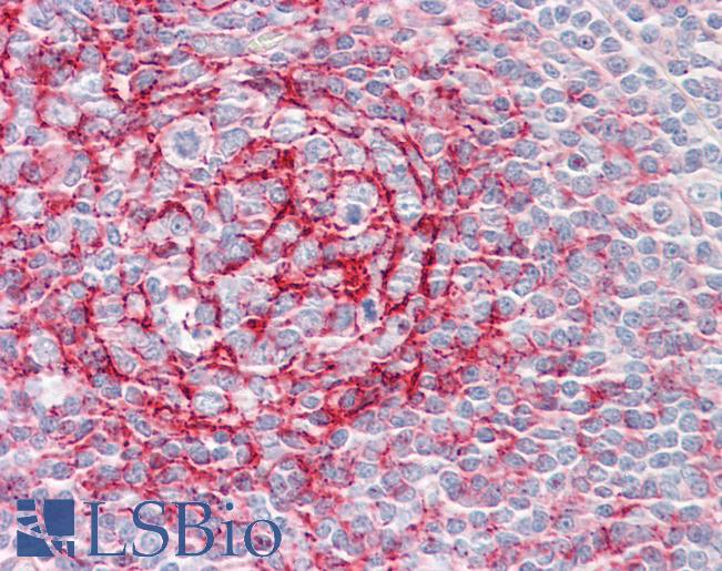 Anti-MTMR1 antibody IHC staining of human tonsil. Immunohistochemistry of formalin-fixed, paraffin-embedded tissue after heat-induced antigen retrieval.