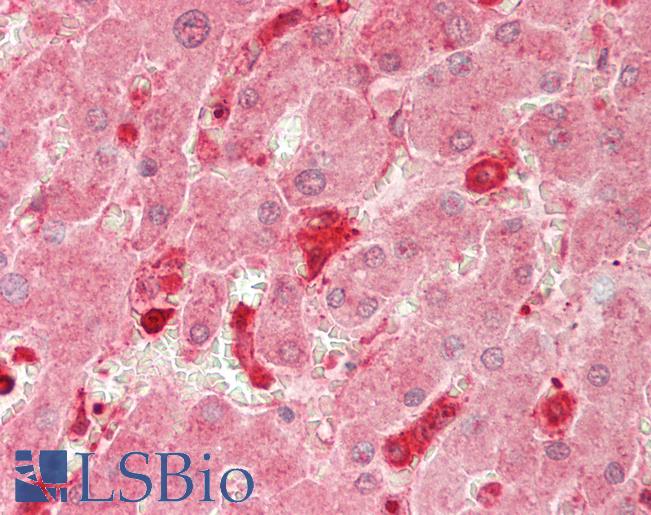 Human Liver: Formalin-Fixed, Paraffin-Embedded (FFPE)