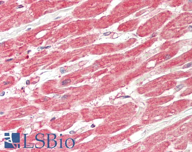 Human Heart: Formalin-Fixed, Paraffin-Embedded (FFPE)