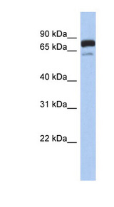 MTMR12 antibody western blot of Human fetal brain lysate.