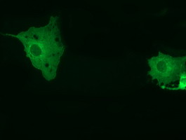 Anti-MTMR14 mouse monoclonal antibody immunofluorescent staining of COS7 cells transiently transfected by pCMV6-ENTRY MTMR14.