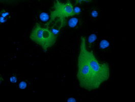Anti-MTMR14 mouse monoclonal antibody immunofluorescent staining of COS7 cells transiently transfected by pCMV6-ENTRY MTMR14.