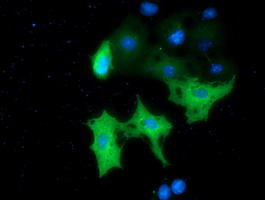 Anti-MTMR14 mouse monoclonal antibody immunofluorescent staining of COS7 cells transiently transfected by pCMV6-ENTRY MTMR14.