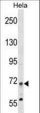 MTMR14 Antibody western blot of HeLa cell line lysates (35 ug/lane). The MTMR14 antibody detected the MTMR14 protein (arrow).