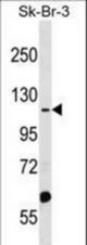 MTMR4 Antibody western blot of SK-BR-3 cell line lysates (35 ug/lane). The MTMR4 antibody detected the MTMR4 protein (arrow).
