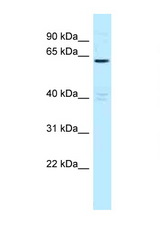 MTMR6 antibody LS-C145888 Western blot of H226 Cell lysate. Antibody concentration 1 ug/ml.