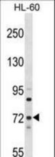MTMR6 Antibody western blot of HL-60 cell line lysates (35 ug/lane). The MTMR6 antibody detected the MTMR6 protein (arrow).