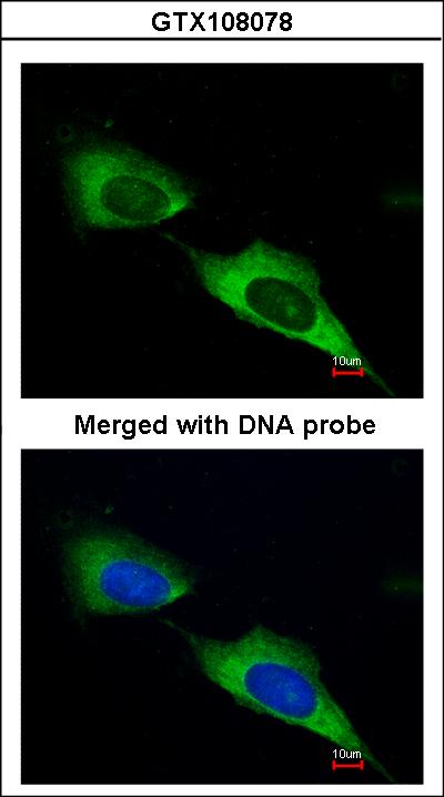 Immunofluorescence of paraformaldehyde-fixed HeLa using MTMR9 antibody at 1:200 dilution.