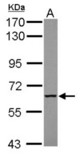 Sample (30 ug of whole cell lysate) A: HeLa 7.5% SDS PAGE MTMR9 antibody diluted at 1:1000