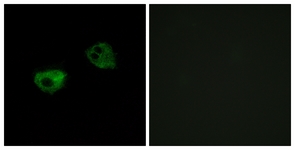 Immunofluorescence of HepG2 cells, using MTR1A Antibody. The picture on the right is treated with the synthesized peptide.