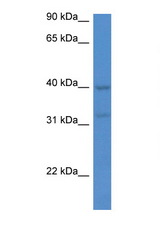 MTNR1A antibody LS-C145401 Western blot of Jurkat Cell lysate. Antibody concentration 1 ug/ml.