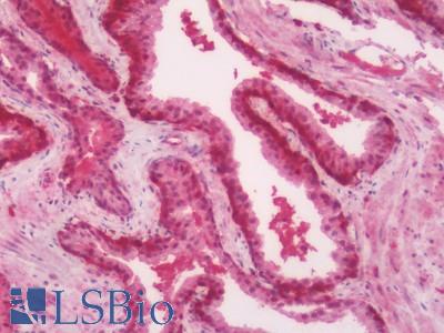 Human Prostate: Formalin-Fixed, Paraffin-Embedded (FFPE)
