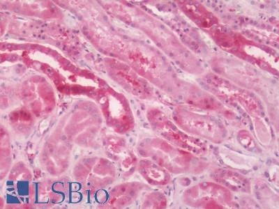 Human Kidney: Formalin-Fixed, Paraffin-Embedded (FFPE)