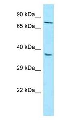 MTNR1B / MT2 antibody Western Blot of HepG2.