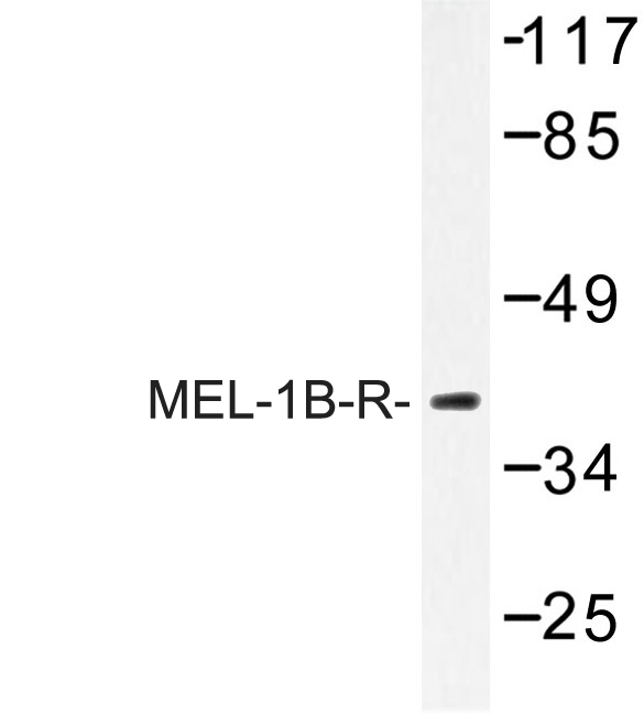 Western blot of MEL-1B-R (V39) pAb in extracts from 293/Jurkat/HepG2 cells.